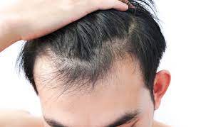 Using Argan Oil to Prevent Gray Hair